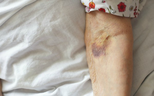 older woman abuse 600